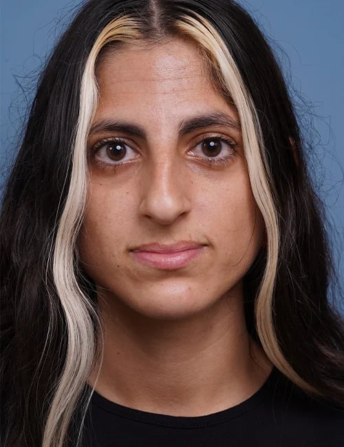 before rhinoplasty female patient front view case 1750 Palm Beach, FL
