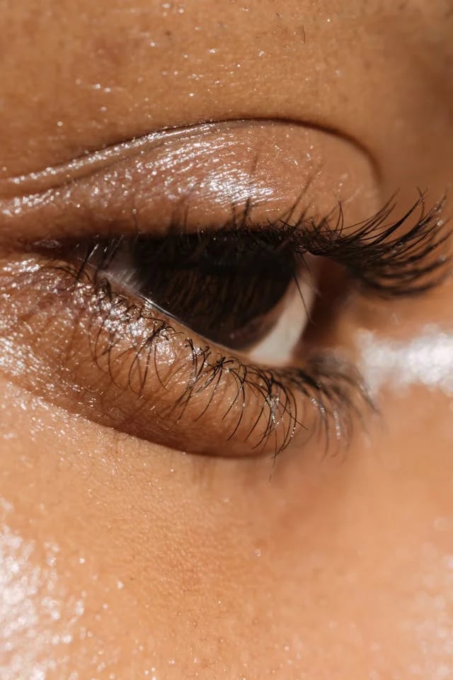 How Can I Fix My Sagging Eyelids?