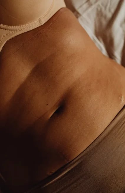 Close view of the abdomen and waistline a 360 tummy tuck reshapes
