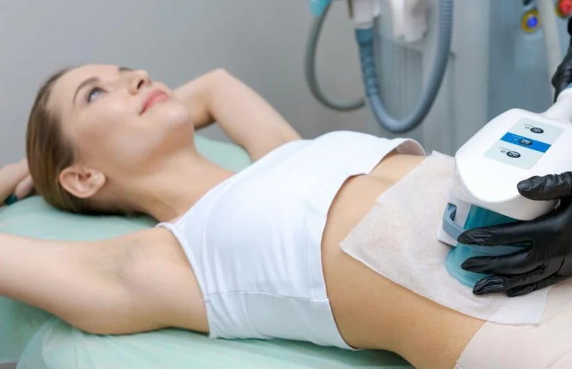 Patient during a non-invasive cryolipolysis body contouring session