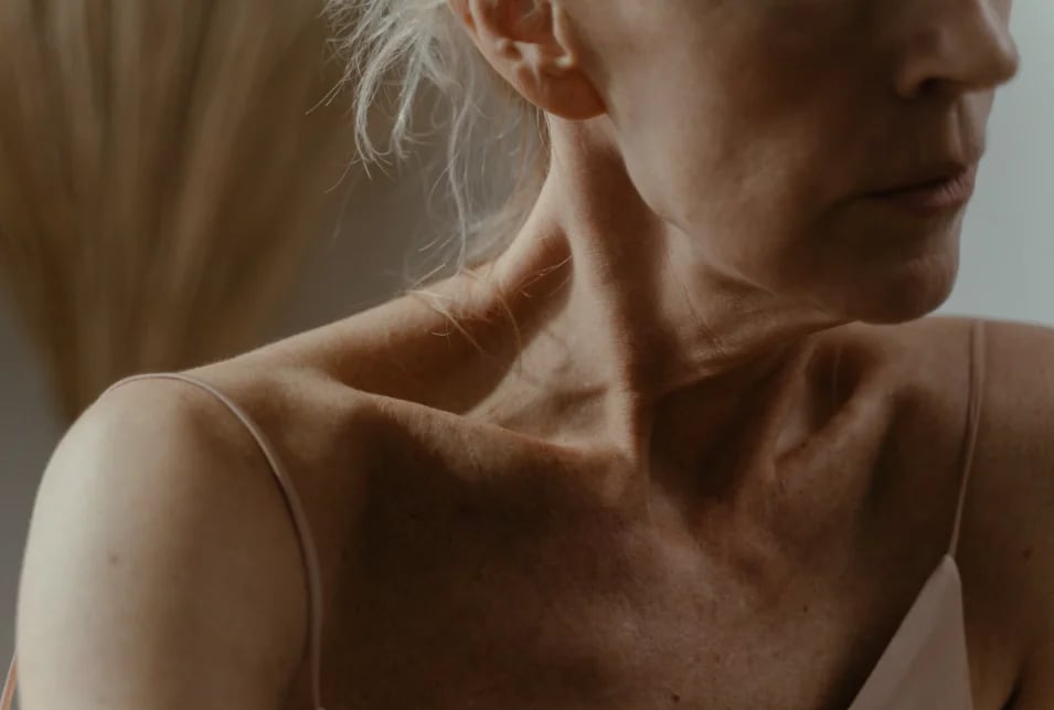 Close view of an aging neck and jawline, where platysmal bands become visible