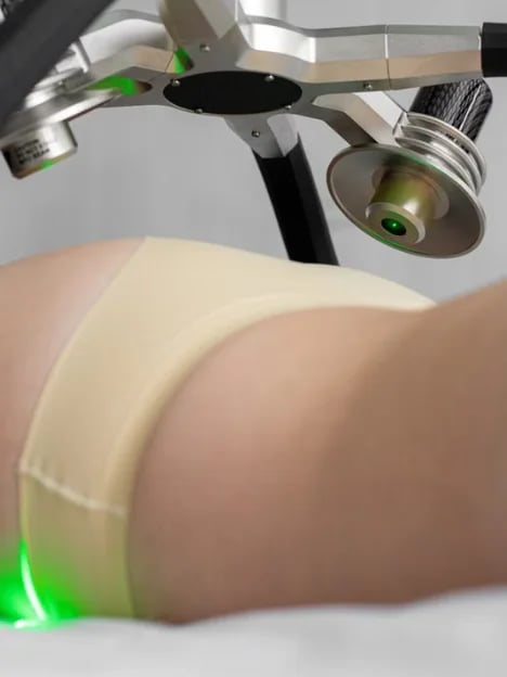 Laser liposuction device applied to the thigh during a spot treatment